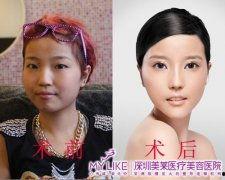 亚洲最佳整容视频,揭秘热门整容视频背后的秘密